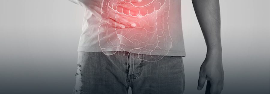 câncer de intestino