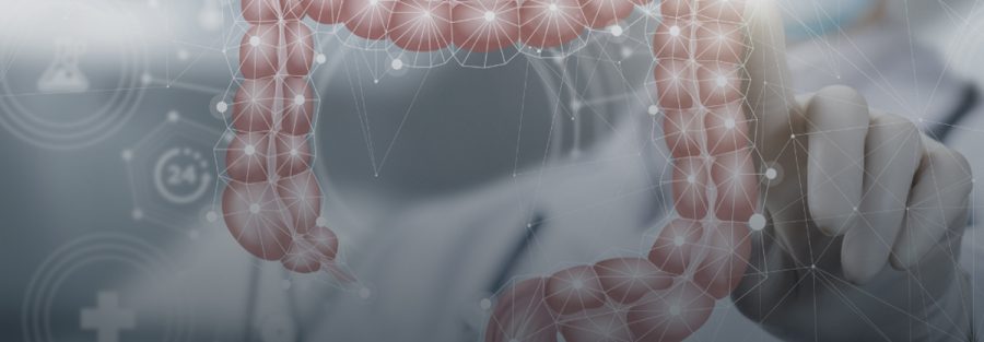 câncer de intestino