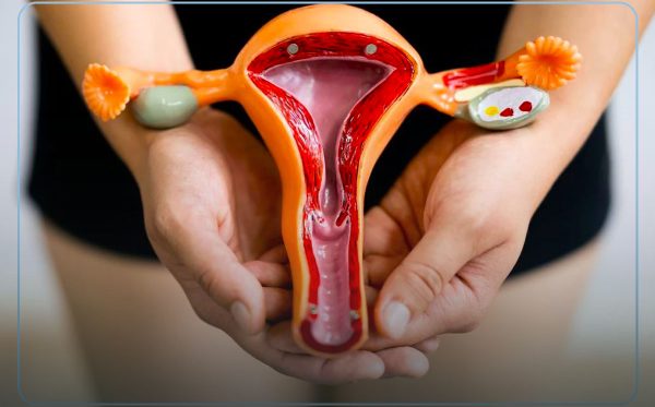 Endometriose profunda: saiba tudo sobre a doença!