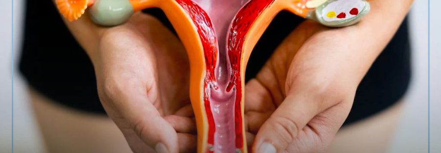 Endometriose profunda: saiba tudo sobre a doença!