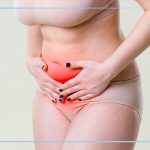 Endometriose intestinal: há tratamento?