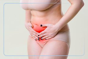 Endometriose intestinal: há tratamento?