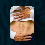 Quais os problemas de saúde associados à diástase abdominal?