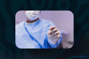 cirurgia de hemorroida a laser